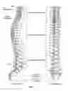 Fig. 02 - Selectively expanding spine cage, hydraulically controllable in three dimensions for vertebral body replacement