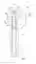 Fig. 04 - TELESCOPIC PROSTHESIS