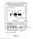 Fig. 05 - Method and System for Providing Speech Therapy Outside of Clinic