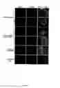 Fig. 09 - Isolation and growth of stem cells from hemangiomas