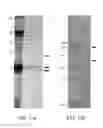 Fig. 17 - PLANT VIRUS