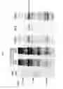 Fig. 05 - crystal polypeptides, polynucleotides, and compositions thereof