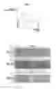 Fig. 06 - Dry-type cleaning chassis and dry-type cleaning device