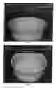 Fig. 04 - Refractory metal pots