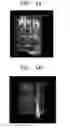 Fig. 04 - Method of arranging components of circuit board for optimal heat dissipation and circuit apparatus having components arranged by performing the method