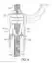 Fig. 05 - LIGHTWEIGHT WHEEL CLAMP FOR VEHICLE WHEEL ALIGNMENT SYSTEM