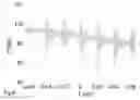 Fig. 07 - Method for determining the injection law of a fuel injector