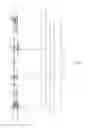 Fig. 08 - Coaxial double drive assembly applicable with shielding elements of a secondary skin facade of a building