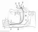 Fig. 01 - NASAL AIRWAY MANAGEMENT DEVICE