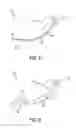 Fig. 04 - NASAL AIRWAY MANAGEMENT DEVICE