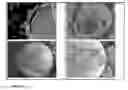 Fig. 04 - SELF-CLEANING COATING COMPOSITION