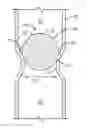 Fig. 01 - Plug and method of unplugging a seat