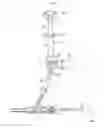 Fig. 01 - Lock device and electric power steering system