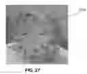 Fig. 28 - Electrochemical separation modules