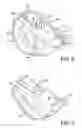 Fig. 05 - Keg cup holder