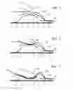 Fig. 02 - Dispensing channel pump