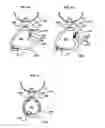 Fig. 05 - Ring Keeper System and Method