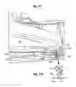 Fig. 06 - Stabilizing mechanism and method for a stowed mobile satellite reflector antenna