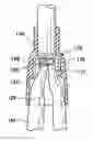 Fig. 01 - METHOD AND APPARATUS FOR ENDOSCOPICALLY PERFORMING GASTRIC REDUCTION SURGERY IN A SINGLE PASS