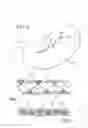 Fig. 04 - METHOD AND APPARATUS FOR ENDOSCOPICALLY PERFORMING GASTRIC REDUCTION SURGERY IN A SINGLE PASS