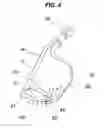 Fig. 05 - Ramp bracket for curtain airbag