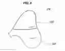 Fig. 06 - Center airbag module for vehicle