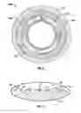 Fig. 05 - Marine riser assembly
