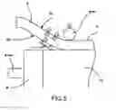 Fig. 04 - Xenon short arc lamp