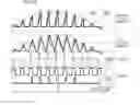 Fig. 11 - Active constant power supply apparatus