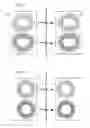 Fig. 04 - Coil system