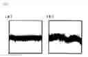 Fig. 06 - Container for Measuring Cell Potential and Method for Producing Same