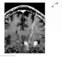 Fig. 01 - Visualizing surgical trajectories