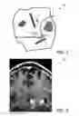 Fig. 05 - Visualizing surgical trajectories