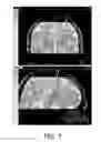 Fig. 06 - Visualizing surgical trajectories