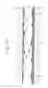 Fig. 158 - Liquid crystal display device