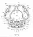 Fig. 05 - Rotational comb drive Z-stage