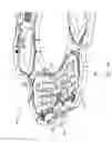 Fig. 14 - Rotational comb drive Z-stage