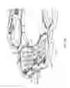 Fig. 15 - Rotational comb drive Z-stage
