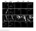 Fig. 01 - Method and system for automatic view planning for cardiac magnetic resonance imaging acquisition