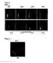 Fig. 04 - Method and system for automatic view planning for cardiac magnetic resonance imaging acquisition