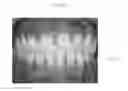 Fig. 02 - Method for acquiring a three-dimensional image of a set of teeth