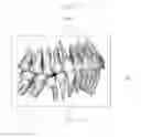 Fig. 04 - Method for acquiring a three-dimensional image of a set of teeth