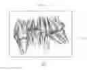 Fig. 05 - Method for acquiring a three-dimensional image of a set of teeth