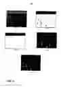 Fig. 05 - Method for detecting and adapting video processing for far-view scenes in sports video