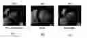 Fig. 01 - Symmetric and inverse-consistent deformable registration