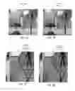 Fig. 10 - Methods and apparatus for de-blurring images using lucky frames