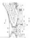 Fig. 31 - Lens barrel with MEMS actuators