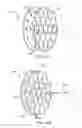 Fig. 14 - VARIABLE FOCUS ILLUMINATOR
