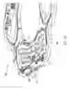 Fig. 14 - Long hinge actuator snubbing