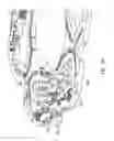 Fig. 15 - Long hinge actuator snubbing